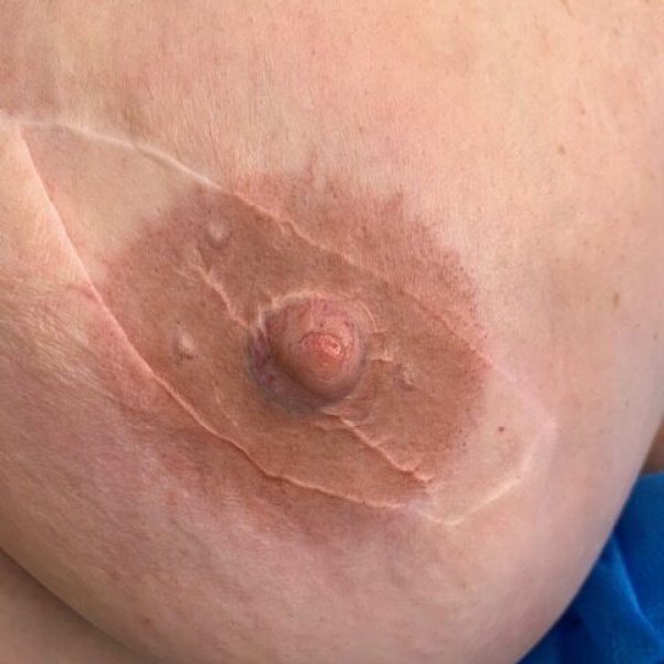 areola tattoo